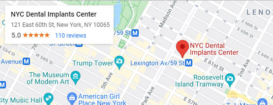 nyc dental implants center | map and directions