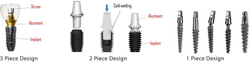 Affordable Dental Implant Materials Pataskala OH