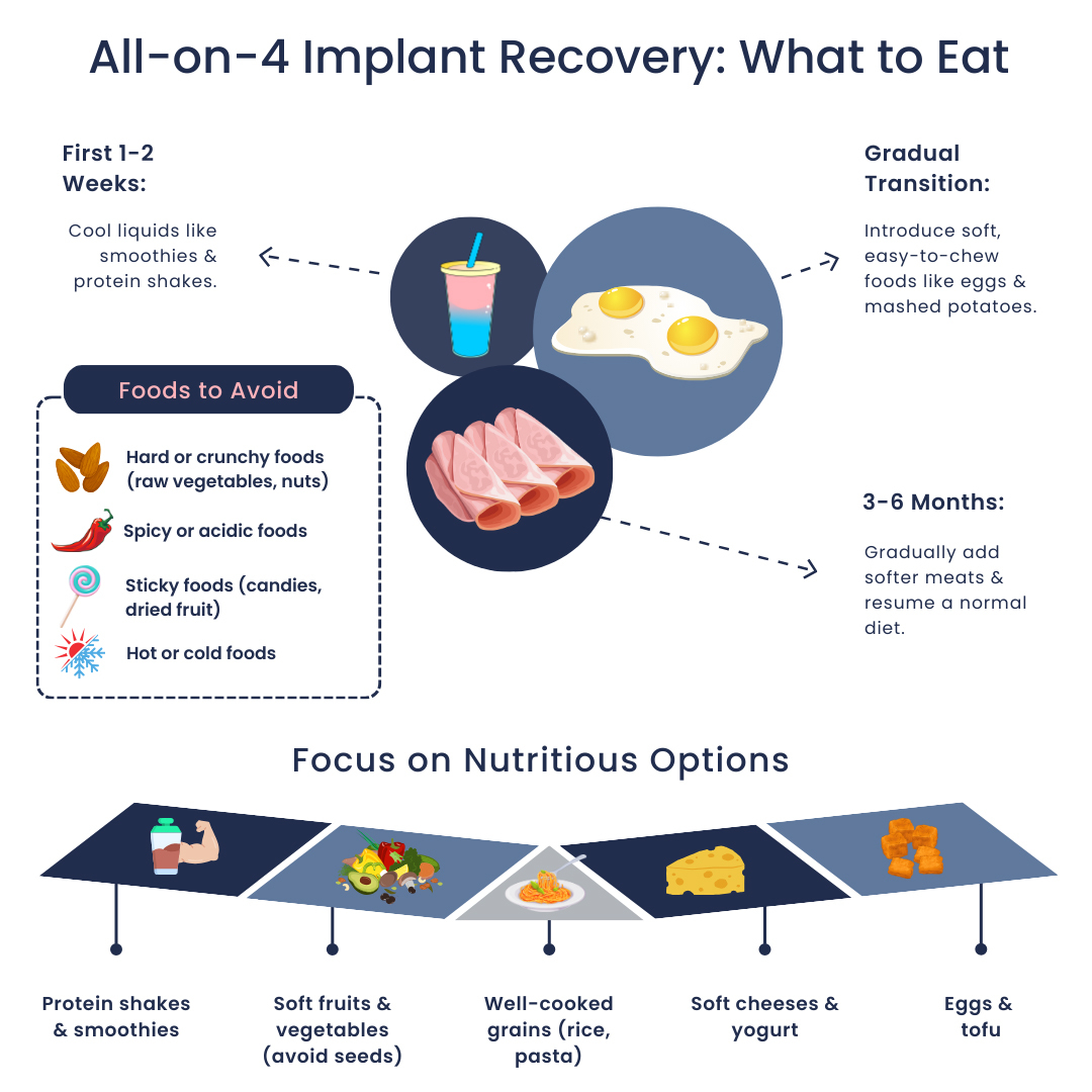 All-on-4 Implant Recovery What To Eat