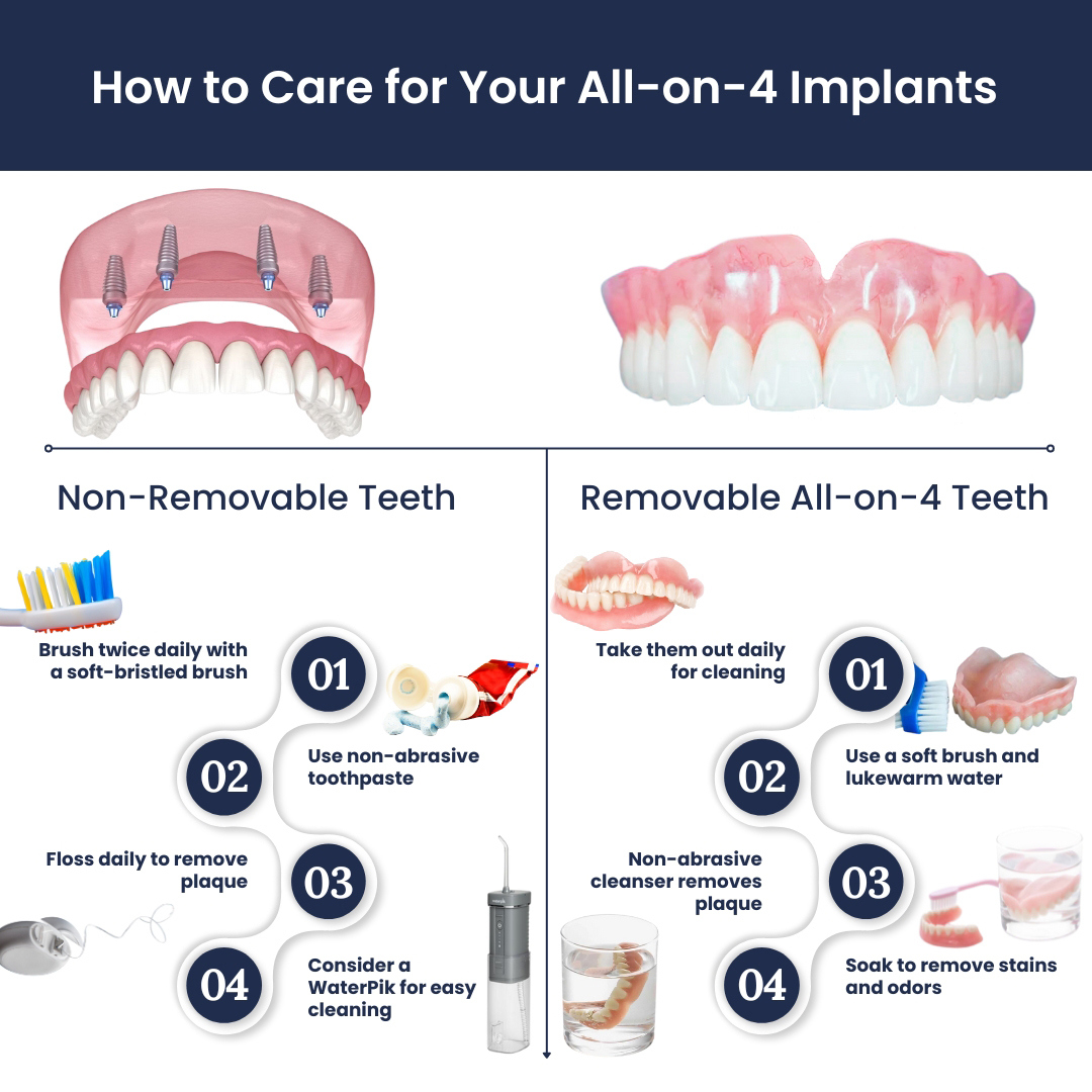 How to Care for Your All-on-4 Implants