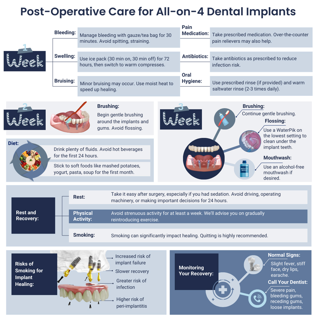 Post-Operative Care for All-on-4 Dental Implants